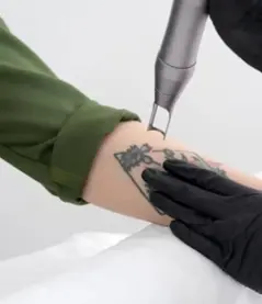 POMEM'DE DÖVME SERBEST Mİ? POMEM’ DE DÖVME VE YARA İZİ HAKKINDA BİLMEN GEREKENLER