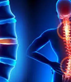 POMEM’de Skolyoz (2025): Kaç Dereceye Kadar Kabul Edilir? Polislikte Skolyozdan Elenir miyim?